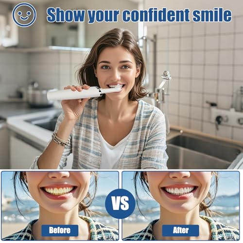 Zahnpolierer, Wiederaufladbare Zahnaufhellung Kit für Zahnreinigung und Aufhellung, Elektrischer Zahnpolierer mit 3-Zahnpolierpaste, 5-Bürstenköpfe, 5-Geschwindigkeitsmodi, LED-Licht – Bild 7