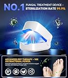 IUHFSIFS Upgrade Antifungal Laser【Light Intensity Enhancement 】【Stronger Red Light - 950nm】Anti Fungal Nail Treatment for Toenail Fungus Treatment, 950nm Infrared Light 500nm Blue - Image 2