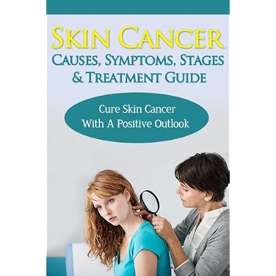 Skin Cancer Causes, Symptoms, Stages & Treatment Guide