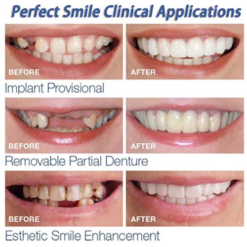 Shopify Upper and lower False teeth cover Perfect Smile Veneers Comfort Fit Flex Denture 1