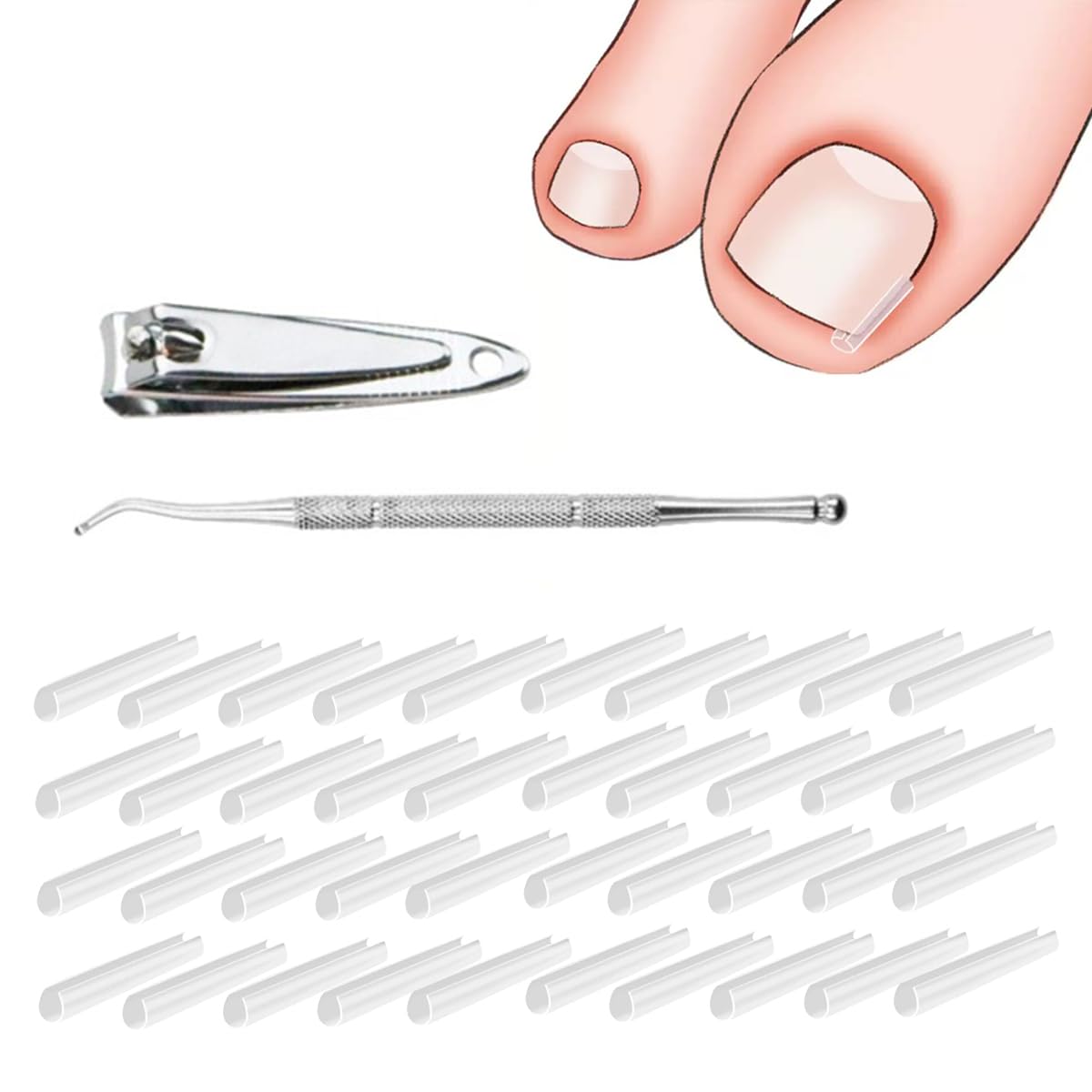 Set correttore per unghie incarnite 40pcs Strisce raddrizzanti per unghie incarnite senza dolore con sollevatore per unghie - Kit di strumenti unghie incarnite facili usare +tagliaunghie
