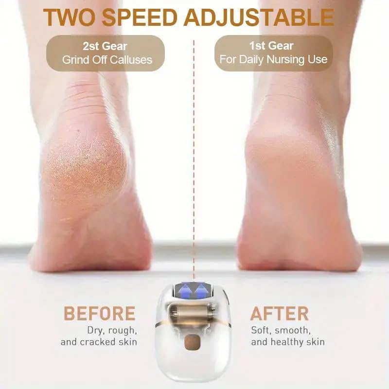 Image of Callus Remover for Feet - Rechargeable Foot Scrubber for Dead Skin & Cracked Heels - Pedicure Device with 3 Roller Heads, 2 Speeds & Waterproof Design for Smooth, Soft Feetr (Callus Remover Pedicure Device)