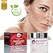 Crema Despigmentante Antimanchas Facial - Blanqueadora Eficaz en Manchas Oscuras por Sobreproducción...