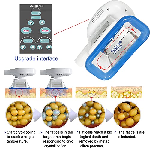 Macchina per Dimagrire Corpo con 3 Manici