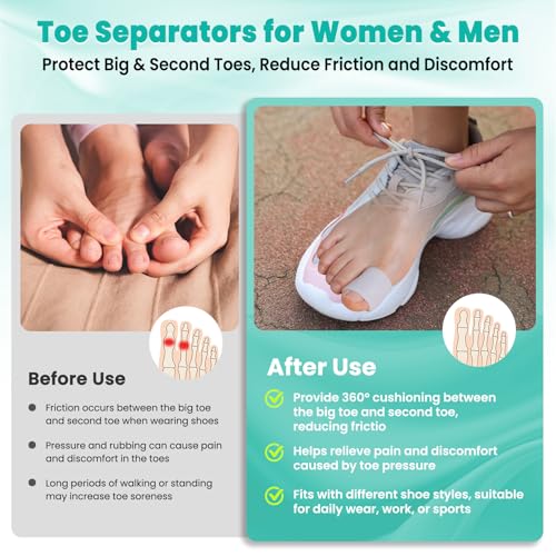 Image of Toe Protectors Women & Men, 20 Pcs Toe Sleeves (Large), Silicone Toe Protectors - Pain Relief Toe Separators for Women, Toe Protector for Bunion Blisters, Hammer Toes, Toenails Loss