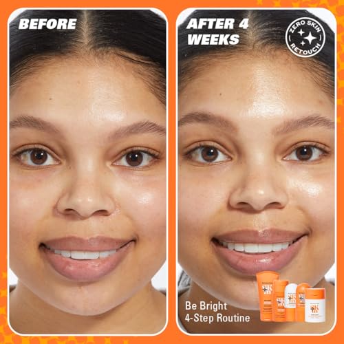 Image of Revolution Skin Be Bright 4 Step Starter Kit, 4 Mini Products | Skincare Set with Cleanser, Toner, Serum & Moisturizer, Vegan & Cruelty-Free