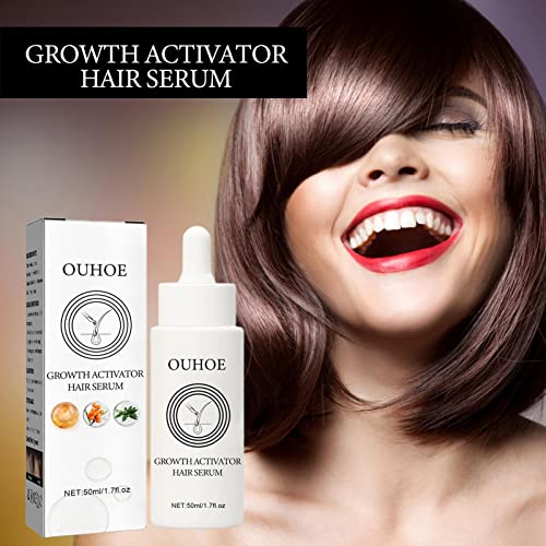 Ativador de Crescimento Capilar - O ativador de cabelo mantém o crescimento do cabelo,Produtos para