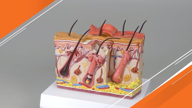 Image of GPI Anatomicals Skin Burn Model, Cross-Section Model Showing Burnt Skin | Human Body and Anatomy Replica for Physiology Education, Anatomical Model for Doctor's Office, Medical Learning Resources