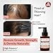 High Potency® Hair Growth Serum – Hair Defence Pro Formula | 24% Clinically Proven Actives with 5% Anagain, 5% Baicapil, 4% Procapil, Redensyl, 2% Capilia Longa, Niacinamide & Copper Peptide 30 mL