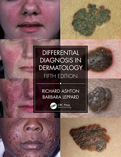 Differential Diagnosis in Dermatology Differential Diagnosis in Dermatology