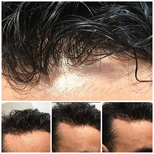 Image of SkyHair 100% Remy Hair Australian Mirage Hair Patch Transparent Poly PU Front and Border, Natural Front Hairline Skin Base for Real Looking Scalp Undetectable Toupee PREMIUM System (8x6, Black)