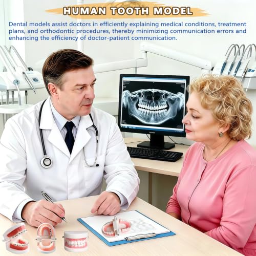 Image of 1 Pack Standard Teeth Model for Dental Training,Teaching,and Practice,Adult Standard Typodont Demonstration Denture Model for Dentists,and Hygienists,Oral Anatomy Demonstration Model