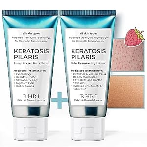 KP Bump Eraser Body Scrub + Keratosis Pilaris Lotion Bundle Set, Strawberry Legs Treatment for Women, Bump Eraser Body Scrub, Keratosis Pilaris, Body Scrub for Strawberry Legs