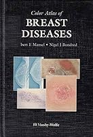Color Atlas of Breast Diseases 0723417210 Book Cover