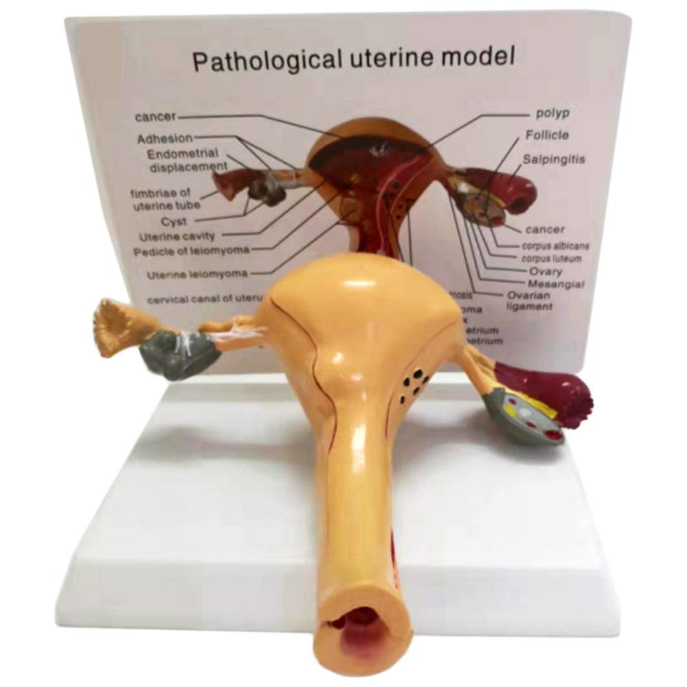 Educational Model Uterus Model Medical Anatomical Human Uterus Model Uterus Ovary Anatomical Model with Pathologies Advanced Simulation Maternal Uterus Structure Model,Medical Models
