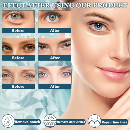 2 Stück Jasminsalbe Plus + Jasmin Salbe Augen, Jasminsalbe Augenringe Schlupflider, Aktiv-Jasminsalbe, Jasmin Creme Augenringe Gegen TräNensäcke, Augen- und Gesichtspflege für Damen und Herren