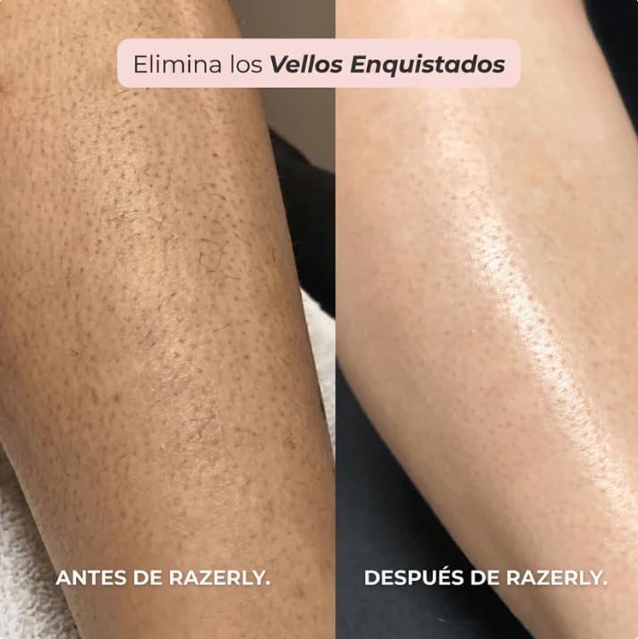 Razerly Maquinilla Mujer/Maquinilla 2 En 1 Para Bikini Y Cuerpo Razerly