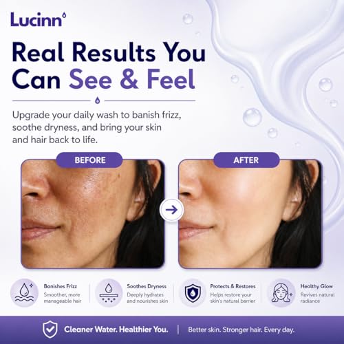 Regadera filtrada Lucinn Pro | Elimina cloro y metales pesados, mejora el cabello y la piel, instalación fácil, incluye filtro de 20 etapas miniatura 5