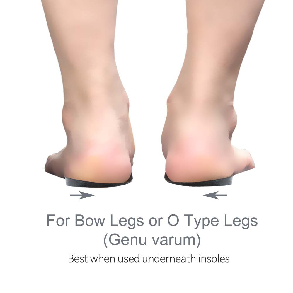KnockKnees Bow Legs O/X Type Medial & Lateral Heel Wedge Insoles