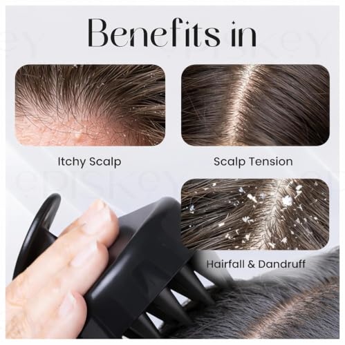Image of Episkey Scalp Massager Shampoo Brush for Hair Wash Anti-Dandruff Silicone Scalp Scrubber with Soft Bristles | Deep Clean, Exfoliation & Hair Growth Ayurvedic Head Massage Brush for Men&Women (BLACK) (PACK 2)