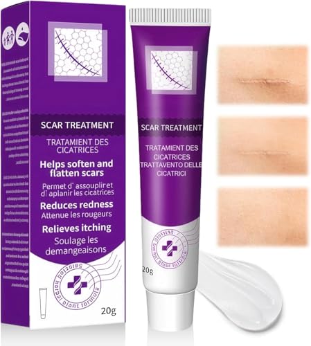 #Commissioniguadagnate<br>Gel Di Eliminazione Della Cicatrice 20g,Uso Quotidiano,Adatto Per Una Varieta Tipi di Pelle,Violetta