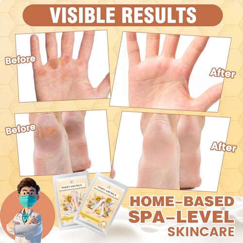 Hydrating-Hand-and-Foot-Mask-3-Foot-3-Hand-Mask-Hand-and-Foot-Care-after-Pedicure-Moisturizing-Socks-for-Dry-Cracked-Heel-Foot-Spa-Honey-Milk-Vitamin-E