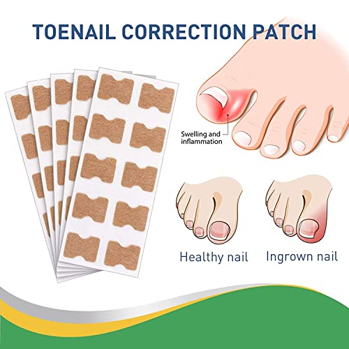 Treatment Ingrown Toenail Corrector Strips,Fitmedify Nail Patches with Nail Correction Tool Kit,Toenail Correction Patch,Ingrown Toenail Removal Kit - Image 4