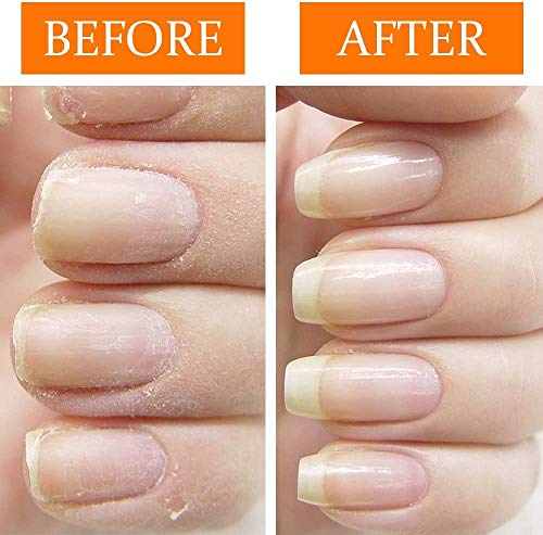 Nail Tek I0096865 Repairs Damaged Nails Kit.Intensive Therapy thumb #4