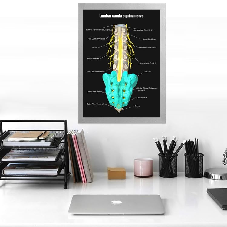 Image of Taanfu Body Educational Learning Anatomy Posters ，Equina Nerve Art Nerve Villi Anatomy Art Poster Digestive System Organs Illustration Small Intestine Physiology Anatomy Wall Art Villi