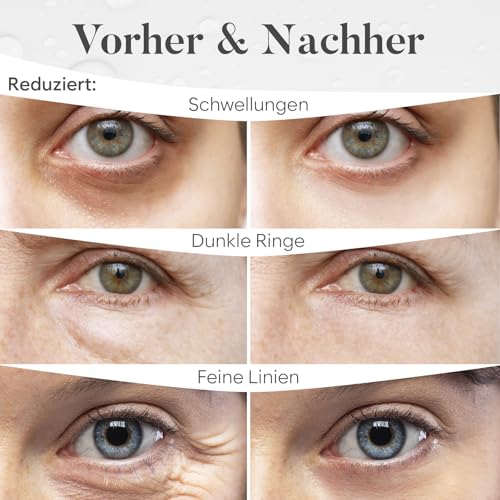 BLOOMORA Gemischte Augenpads (30 Paare) - Eye Pads mit Niacinamid & Augenpads Hyaluron - Augenpadz Gegen Augenringe - Augenringe Entfernen - Eye Patches