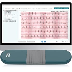 Livenpace 24-Hour Heart Health Monitor | Personal Holter with AI-Enabled Analysis to detect 16 Irregular Rhythms…