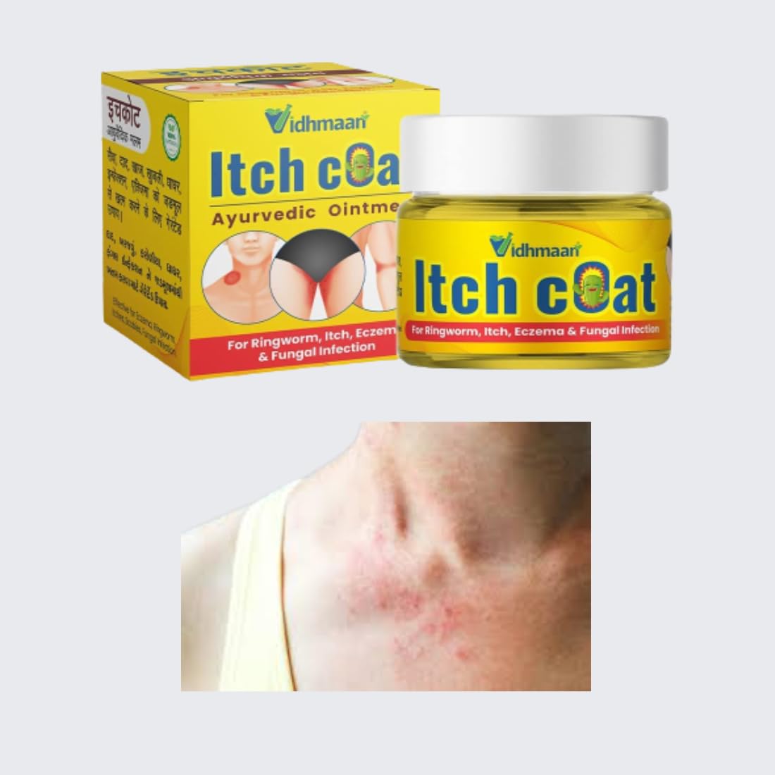 Rahipa Vidhmaan Ayurvedic ItchCoat Anti fungal Malam - for Ringworm, itching, Eczema & Fungal Infection (50_GR)