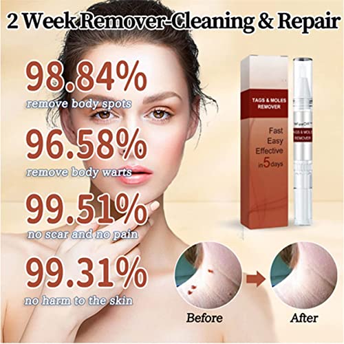 Wipeoff Tag & Moles Remover, Wipe Off Tags e Mole