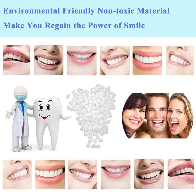 DIY Cosmetic Teeth Repair 10g – Temporary Moldable Dental Kit - Image 3 thumbnail