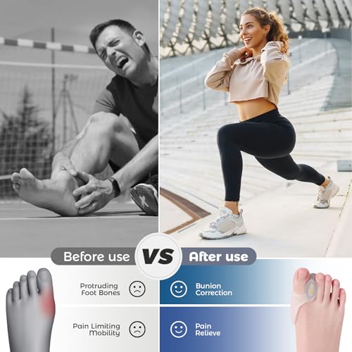Image of Adjustable Bunion Corrector&Toe Separators for Women and Men-Gel Toe Spacers for Big Toe Straightening,Bunion Relief,Overlapping Toes,Cushion Pads-4-Level Adjustable Spreader Kit