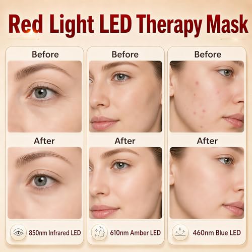 Image of FSA Eligible Items List, LED Red Light Therapy for Face Mask
