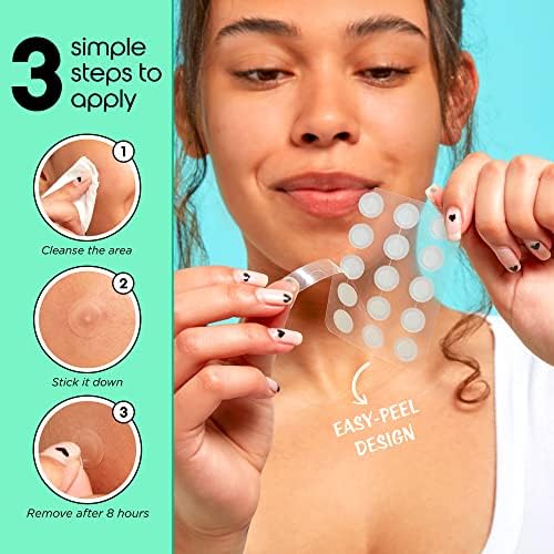 Patch Perfect Invisible Pimple Patches (102 Count) - Hydrocolloid Spot Patches which Accelerate Healing, Absorbing Dots for Spot Treatment, Vegan Spot Stickers, Fast-Acting Acne Patch (Two Sizes)