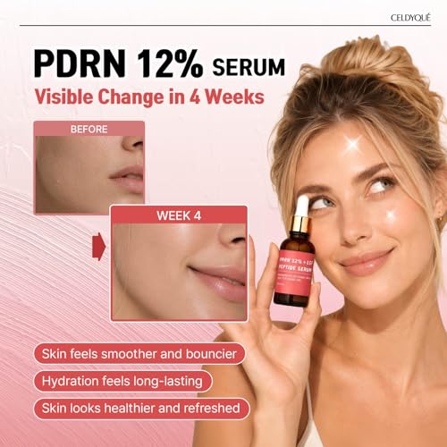 Image of Salmon DNA PDRN 120,000 ppm EGF Peptide Microneedling Serum w /Volufiline, Phyto PDRN 12%, Growth Factor - Anti-Aging Face Serum with Niacinamide, Hyaluronic Acid 1 Fl Oz Korean Skincare