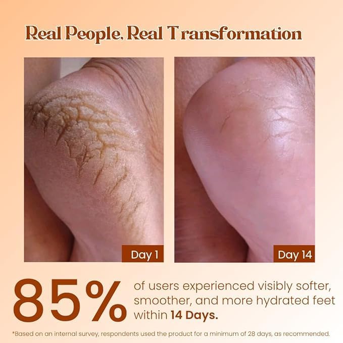 Image of Pokonut Foot Care Cream (Pack of 2)