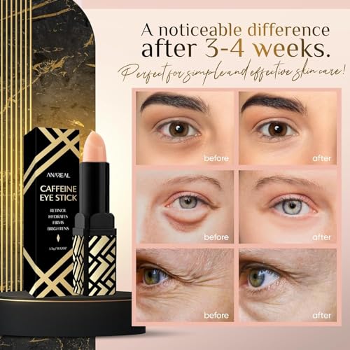 Anareal Caffeine Under Eye Balm: Hydrating Eye Brightener Stick Cream For Dark Circles & Puffiness, Anti-Wrinkle Korean Skincare Treatment With Retinol, Instant Cooling Glow For Eyes thumb #2