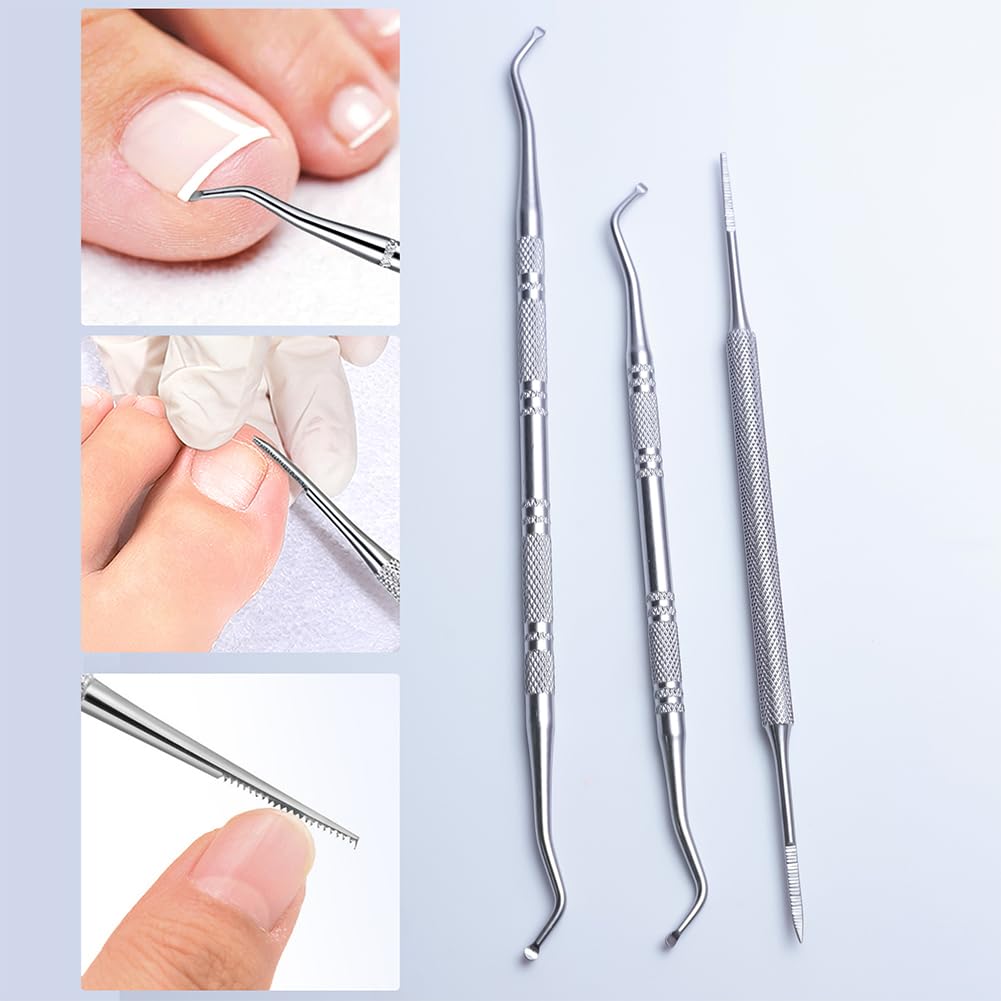 3 -Piece Bundle of Ingrown Toenail Files Made of Stainless Steel Double - Sided Tools for Expert Nail — view 5