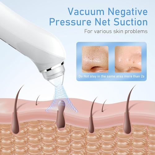Image of Facial Pore Blackhead Remover Vacuum, 1080P Camera Blackhead Remover, 20x Zoom, 8 LEDs & 3 Suction Modes, 800mAh Battery & USB - 6 Heads Pore Cleaner Kit for Women&Men(White)