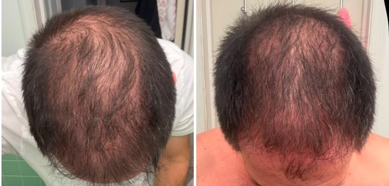 NIOXIN System 2 Scalp + Hair Thickening Conditioner for Natural Hair with Progressed Thinning | Boost Hair Density with Niacinamide & Biotin | Refreshed Scalp with Healthy Shine