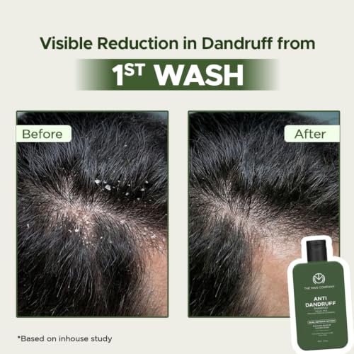 Image of The Man Company Anti-Dandruff Shampoo for Men with 2% Salicylic Acid, Piroctone Olamine & Climbazole | 200 ml | Controls Dandruff from First Wash | Reduces Scalp Itch & Flakes | Oil Balance & Hair Strength | Sulfate-Free Daily Shampoo