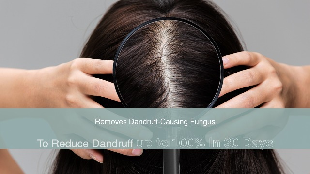 Image of Bare Anatomy Expert Anti-Dandruff Shampoo + Mask|Dandruff Reduction|Targets Oily Scalp & Sheds Dry Flakes|Advanced Hair Growth Serum|Hair Growth & Hair Fall Control Serum For Women & Men, 550 gm