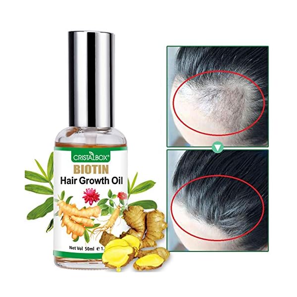 Hair-Growth-Oil2021-Hair-Growth-SerumHair-GrowthStops-Hair-Loss-Hair-Thinning-Treatment-Hair-Growth-TreatmentEssential-Oil-for-Women-Men-50ml Hair Growth Oil,2021 Hair Growth Serum,Hair Growth,Stops Hair Loss, Hair Thinning Treatment, Hair Growth Treatment,Essential Oil for Women Men-50ml…