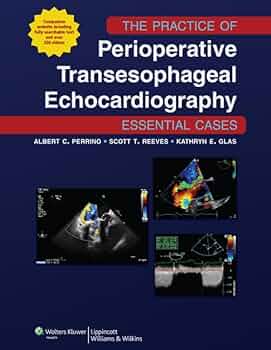 健康・医学 Perioperative Transesophageal Echocardio Amazon | The Practice of Perioperative Transesophageal