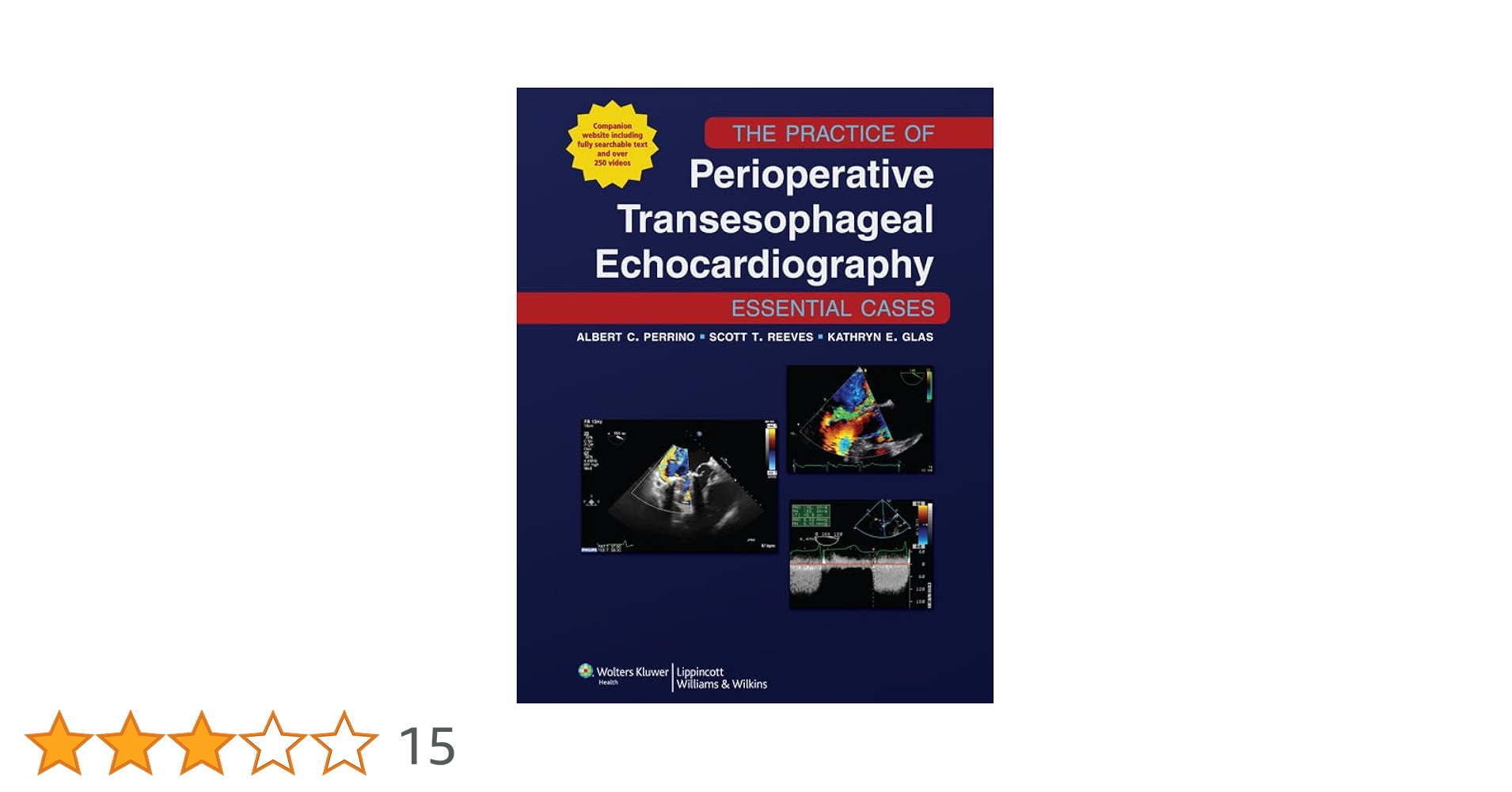 健康・医学 Perioperative Transesophageal Echocardio Perioperative Transesophageal Echocardiography: A Companion