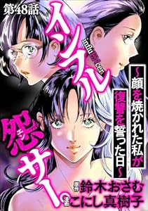 インフル怨サー。 ～顔を焼かれた私が復讐を誓った日～（分冊版） 【第48話】 (comic RiSky(リスキー))