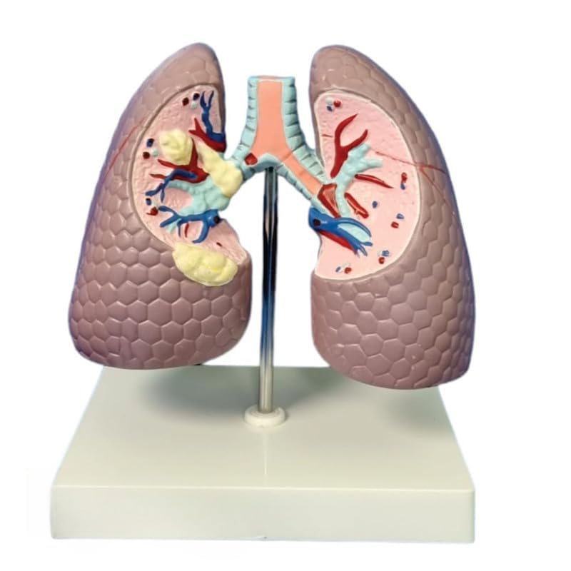 See full amazon price history chart for GD ANATOMICALS ® Lung Model - Educational Tool for Medical Study - Detailed Human Lung Model for Medical and Science Demonstrations GD ANATOMICALS ® Lung Model - Educational Tool for Medical Study - Detailed Human Lung Model for Medical and Science Demonstrations (B0CYCBK6NM) Amazon Price History, Amazon Price Tracker